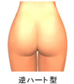 hip03.jpg